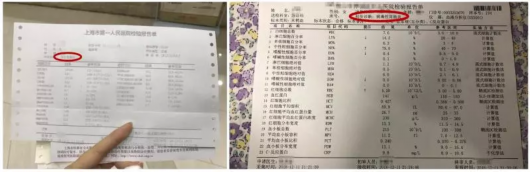 沪网红酒店餐厅把人吃到上吐下泻芒果体育 MGTY 芒果体育网(图2)